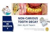 Non Carious Tooth Decay PrevDent KG UNSOED