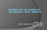 Retinoscopy on human eye