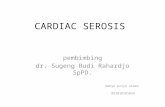 Cardiac Sirosis