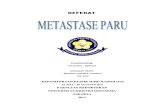 Referat Metastase Paru New