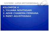 Systemic Lupus Erythematosus Ppt