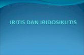 Iritis Dan Iridosiklitis