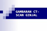 Gambaran CT-Scan Ginjal