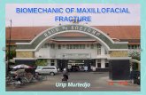1 Biomechanic of Maxillofacial Fracture