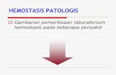 hemostatis Patologis