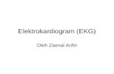 Elektrokardiogram (EKG)