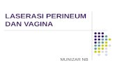 Laserasi Perineum Dan Vagina