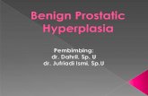 Benign prostat hiperplasia