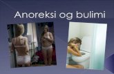 Anoreksi og bulimi