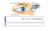 Drying Eye