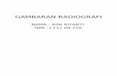 GAMBARAN RADIOGRAFI