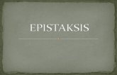 epistaksis (mimisan)