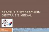 Fractur Antebrachium Dextra