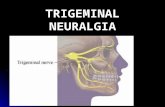 Neuralgia Trigeminus