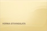 Hernia Strangulata ppt