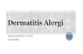 Dermatitis Alergi