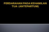 slide perdarahan-antepartum.ppt