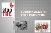 Tuberkulosis (Tb) Paru