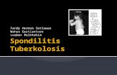 Spondilitis Tuberkolosis