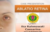 CASE Presentation- Ablasio Retina
