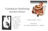 Gambaran Radiologi Kanker Kolon