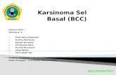 Karsinoma Sel Basal (BCC)