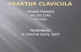 Fraktur Clavicula Pp