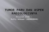 Tumor Paru Dan Aspek Radiologisnya