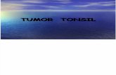 Sss - k44 (Tumor Tonsil)