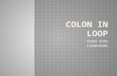 Colon in Loop
