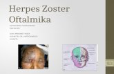 Herpes Zoster Oftalmika