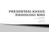 PRESENTASI KASUS Radiologi