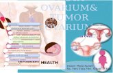 Kista Dan Tumor Ovarium