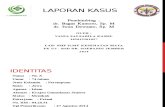 Lapsus Vania - Pterigium