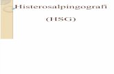 Histerosalpingografi (HSG)
