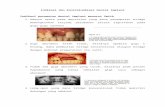 Indikasi Dan Kontraindikasi Dental Implant
