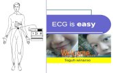 ECG is easy