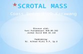 151046750 Scrotal Mass Ppt