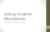 Askep Fraktur Mandibula.ppt
