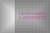 OSTEOGENESIS IMPERFECTA Jadi.ppt