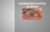 Konjungtivitis Alergi Power Point