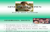 Sindroma Down