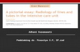 Journal a pictorial essay Radiology of lines and tubes in the ICU.pptx