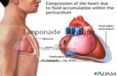 Tamponade Jantung