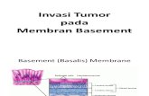 Invasi Tumor pada Membran Basemen.pptx