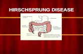HIRSCHSPRUNG DISEASE