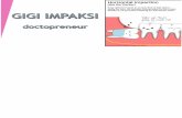 Gigi Impaksi / Impacted Tooth by Doctopreneur