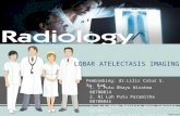 Jurnal Radiologi Atelektasis