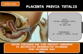 77510443 Review Plasenta Previa