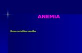 Asty Anemia